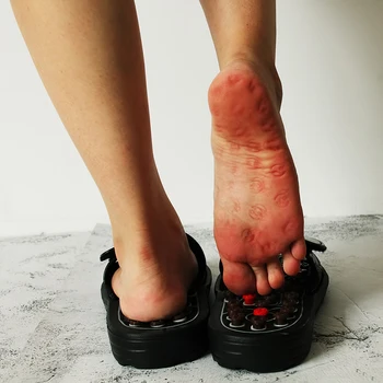 Acupoint Masažo Šlepetės Vyrų/Moterų Sandalai Kinų Pėdų Akupresūra Terapijos Medicinos Sukasi Foot Massager Batai vyriški Unisex