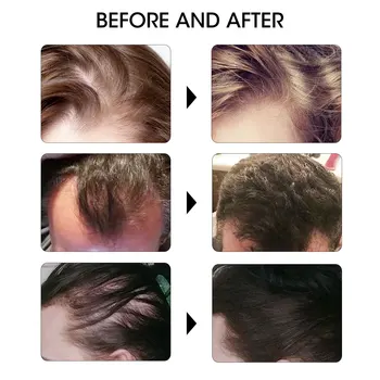 20ml Greitai Plaukų Augimo Serumas Anti užkirsti Kelią Plaukų Prarasti Skystį Pažeistų Plaukų Remontas Gydymas Blakstienų Antakių Auga Storas Priežiūra