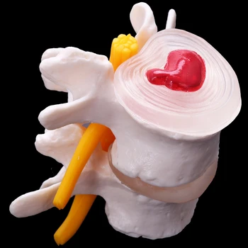 Žmogaus Anatomija Skeletas, Stuburas 4-Etapais Juosmeninės Stuburo Modelis Kaukolės Smegenų Traumos Mokymo Reikmenys