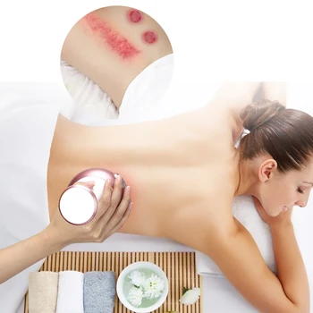 Elektrinis Vakuumo Massager Guasha Kūno Formavimas Massager Elektros Medicininė Terapija 9 Įrankių Grandymo Šildymo Akupunktūros Terapija