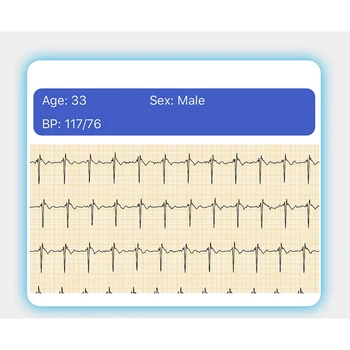 Populiariausi Pasiūlymai E80 Smart Žiūrėti Kūno Temperatūros Matavimo PPG+EKG IP68 Vandeniui Smart Žiūrėti